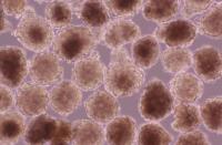 ヒトiPS細胞から作製した心筋球移植による心臓再生に成功 －移植後の不整脈を抑えた細胞移植治療が可能に－