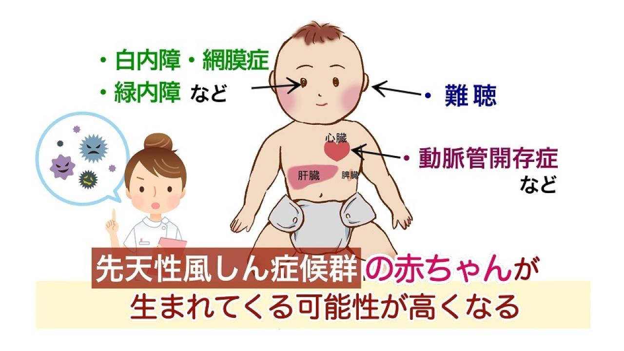 風しん対策のためのクーポン配布、対象者は昭和３７年度～昭和５３年度生まれの男性 その1